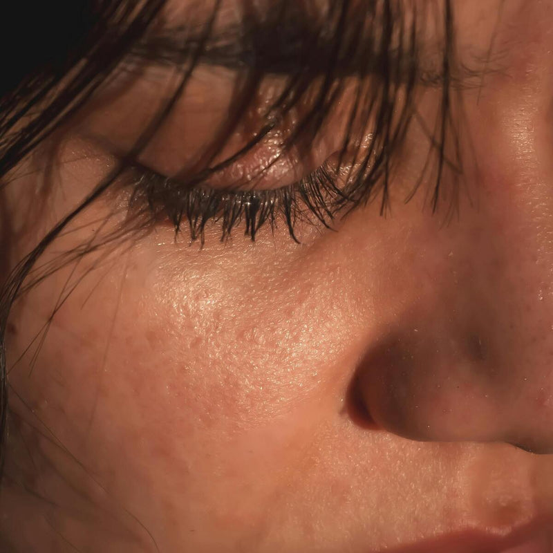 irritation-peau-autour-des-yeux